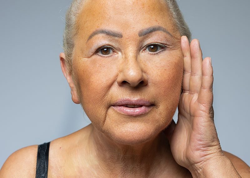 Facelift in de praktijkkliniek van Dr. Million, Oldenburg Facelift