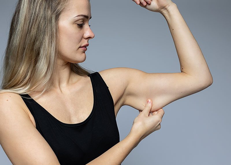 Arm